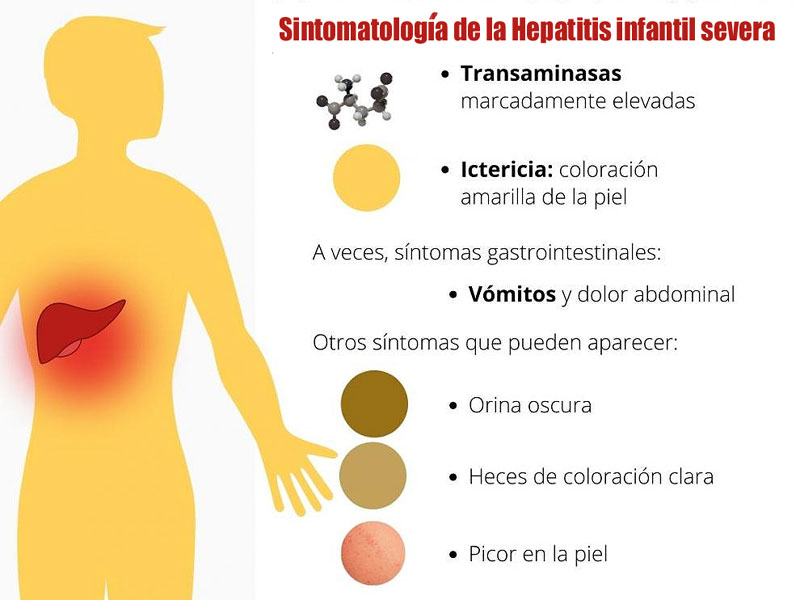 Ante cualquiera de estos síntomas, hay que acudir al médico a la brevedad. Fuente: UK.