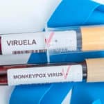 Cambiar el nombre de un virus, que lleva 50 años etiquetado como viruela del mono, no modifica el estigma. Una campaña educativa sí.